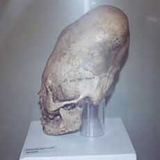 Craneo-cultura-paracas